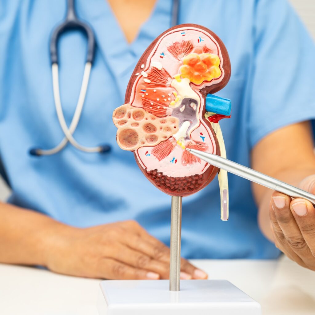 Orientación en etapas avanzadas de enfermedad renal